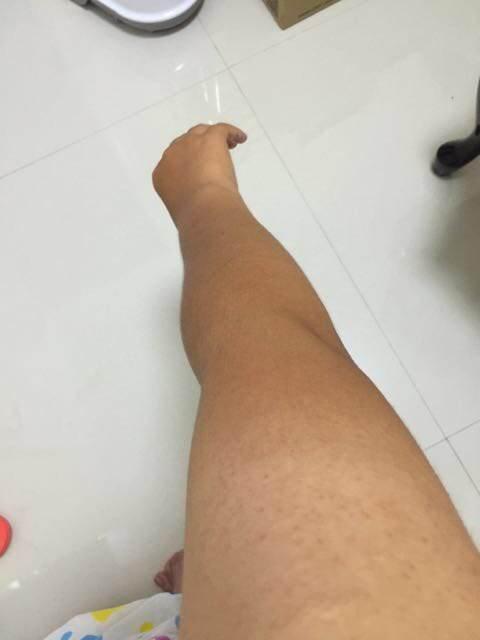 烟酰胺会长毛是真的吗,烟酰胺真的会让皮肤长毛吗