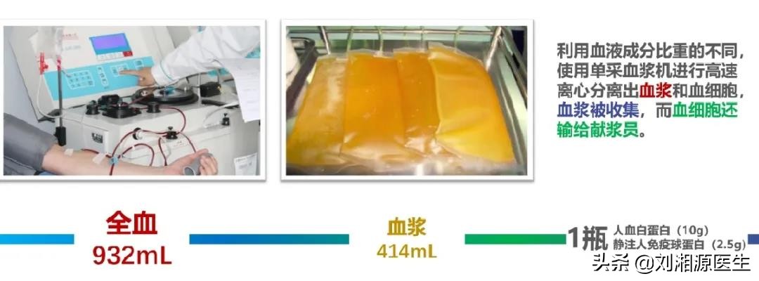 丙种球蛋白妊娠,静脉注射免疫球蛋白保胎