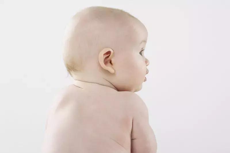 婴儿的头发为什么会一片密一片稀,小孩子头发稀是缺什么