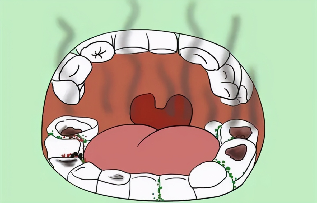 我的笑容就像一个空洞！”22岁女子吸毒6年，瘦到脸凹牙拔光…