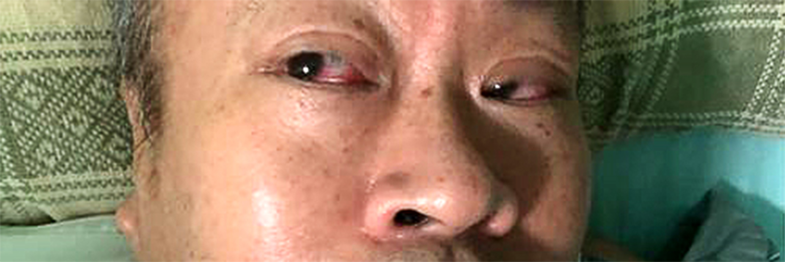 老人晕倒怎么排除是否中风,老年人晕倒病因