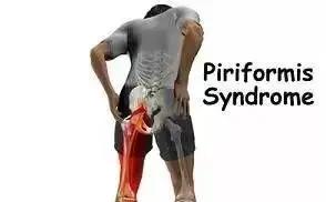 钱包越厚，屁股越痛？这款富贵病康复训练保你入股不亏