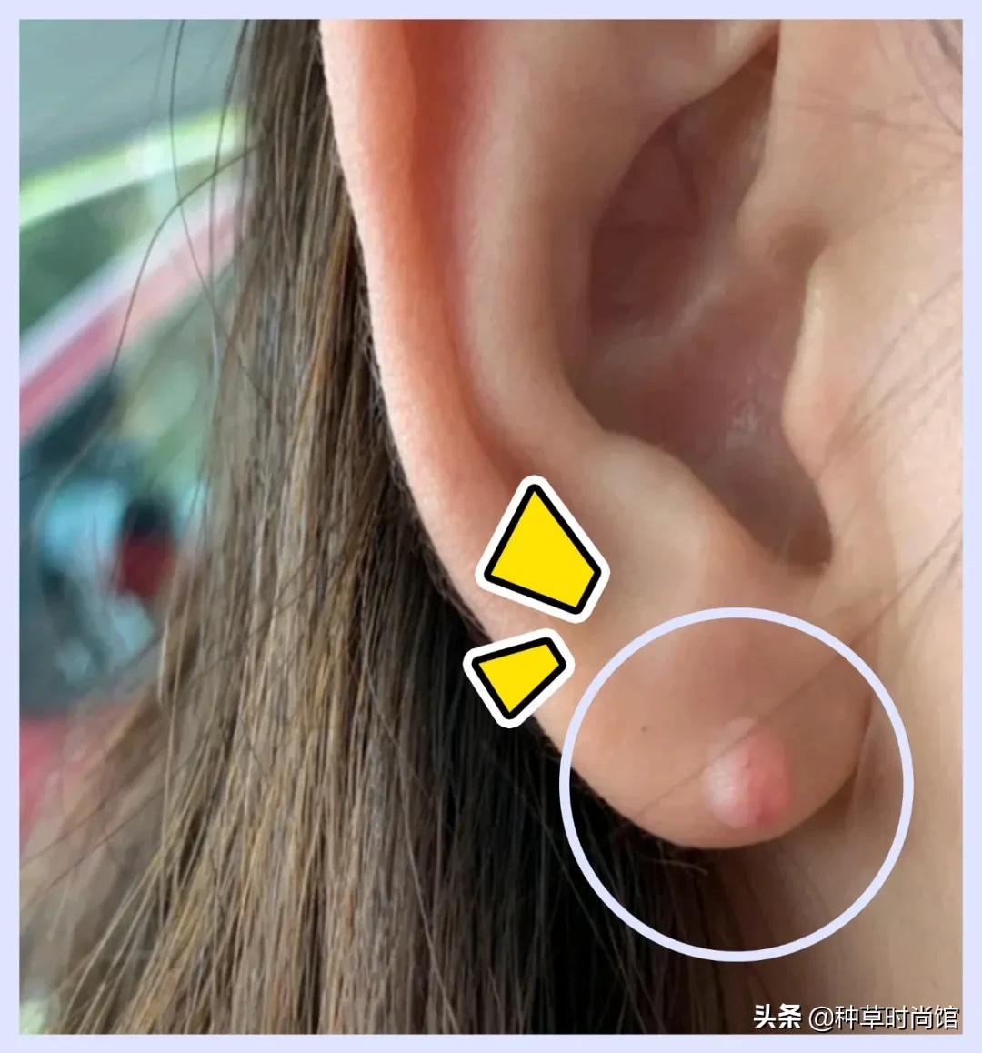 这5类人不能打疫苗,第一次打耳洞千万别踩雷