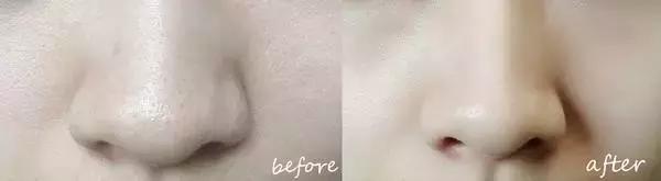 护肤太多的坏处有哪些呢,护肤越补越糟糕