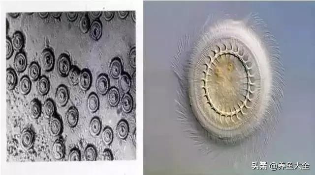 寄生虫多达6000条这种东西别乱吃,寄生虫的典型症状和表现