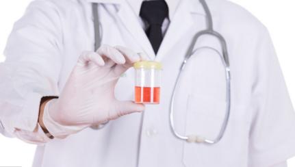 尿酸高5个点严重吗,尿酸居高不下经常做三个动作