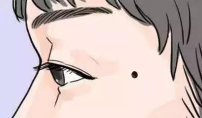 黑痣有去除的必要吗,黑痣或者黑色素要祛除吗