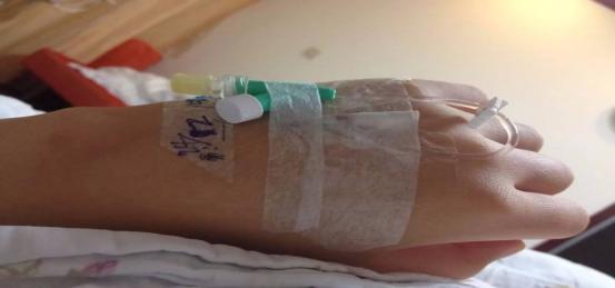 疫情期间“菊花”殇，逼不得已开痔疮