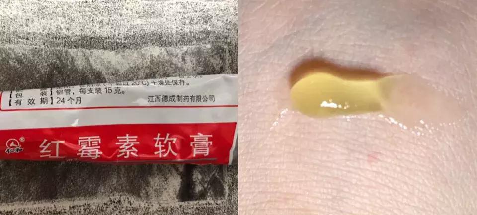 祛痘去黑头有什么药膏推荐,祛痘去黑头真实测评