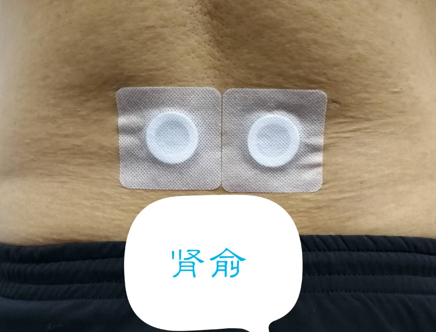 沈阳名中医讲解,有图有真相:周末三九贴敷,穴位用药作用这么看