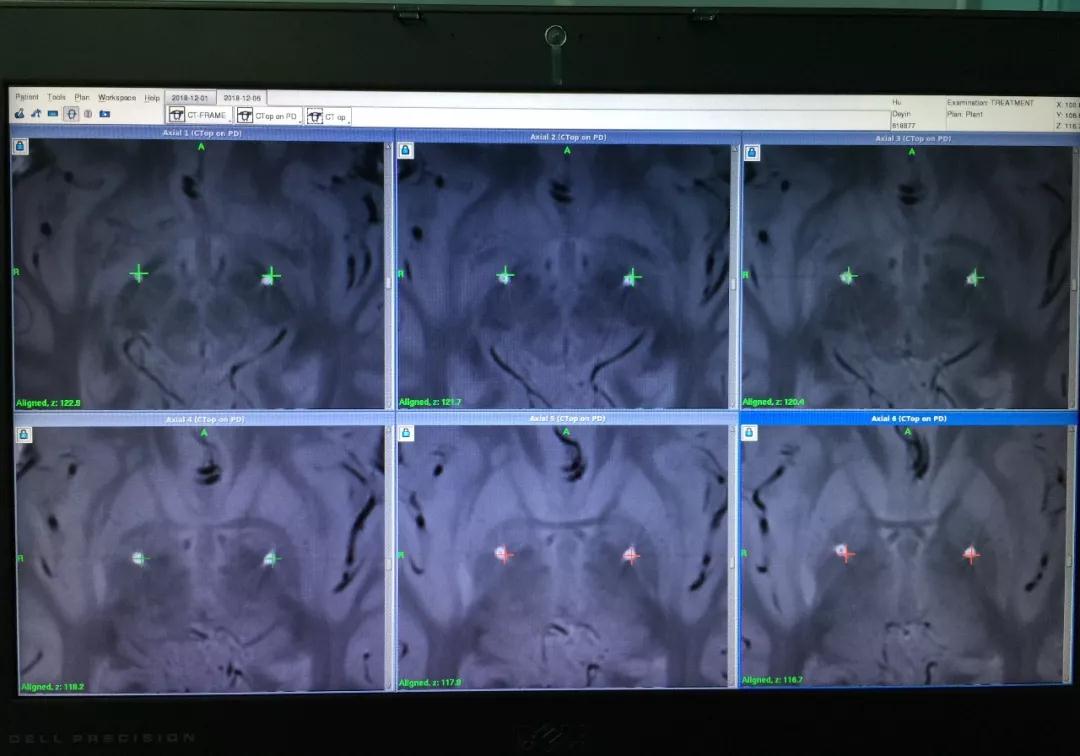 蔡晓东深圳第二人民医院,深圳二医院蔡晓东
