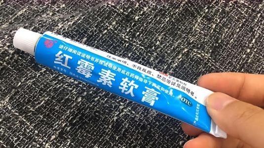 过敏性皮炎专用药膏有哪些,严重过敏性皮炎最好的用药是什么
