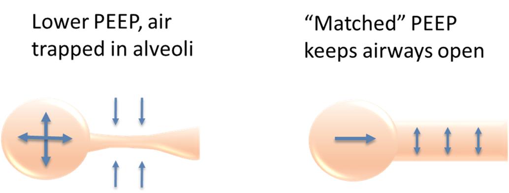新冠肺炎机械通气系列课程(讲义)-阻塞性肺病的机械通气