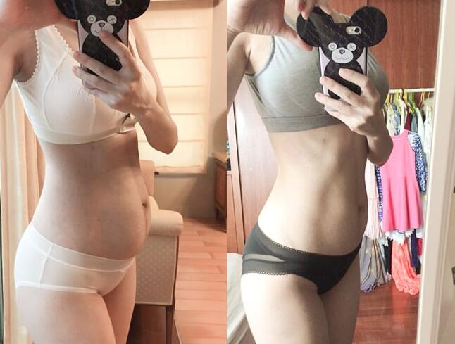 骨盆前倾穿塑身衣有用吗,别上当塑身衣真的有用吗