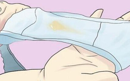 妇产科医生教你：从*裤内**看自己是否有妇科病