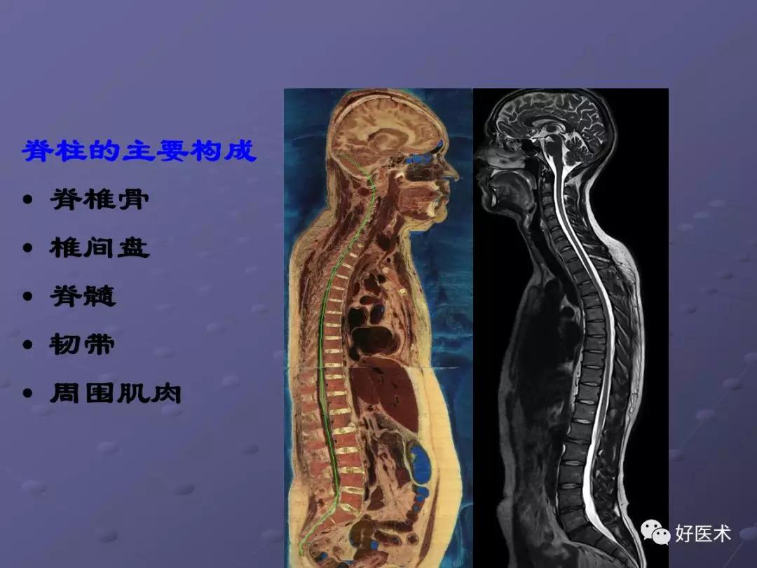 脊柱mri有哪些特点,乳腺疾病的mri诊断及鉴别