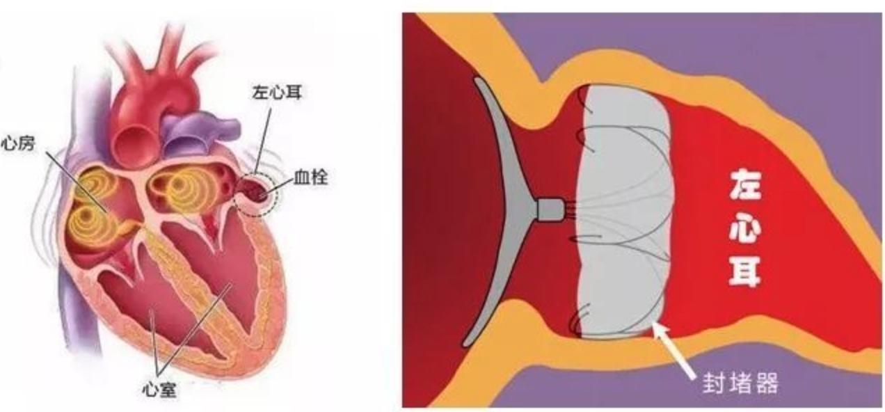 一颗心扑通扑通的狂跳歌词意思,心脏跳到200多得了房颤