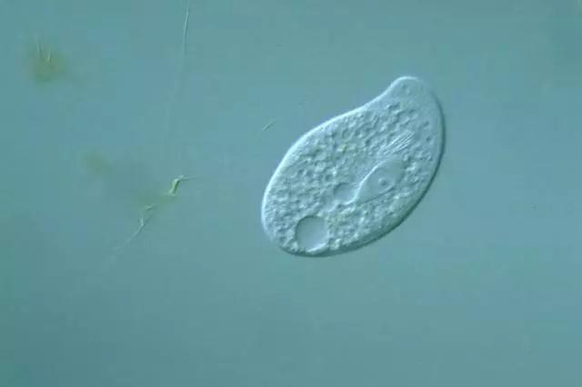 收藏!24种污水处理微生物菌相及指导意义,环保人必看(多图)