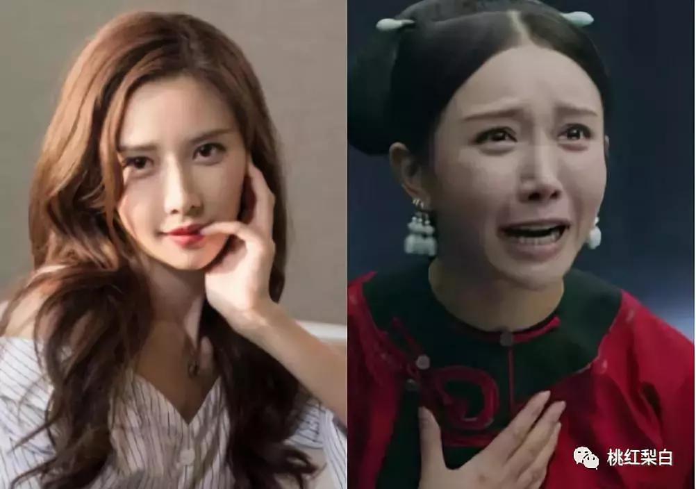 整容脸和天生脸差距,整容明星脸都一样