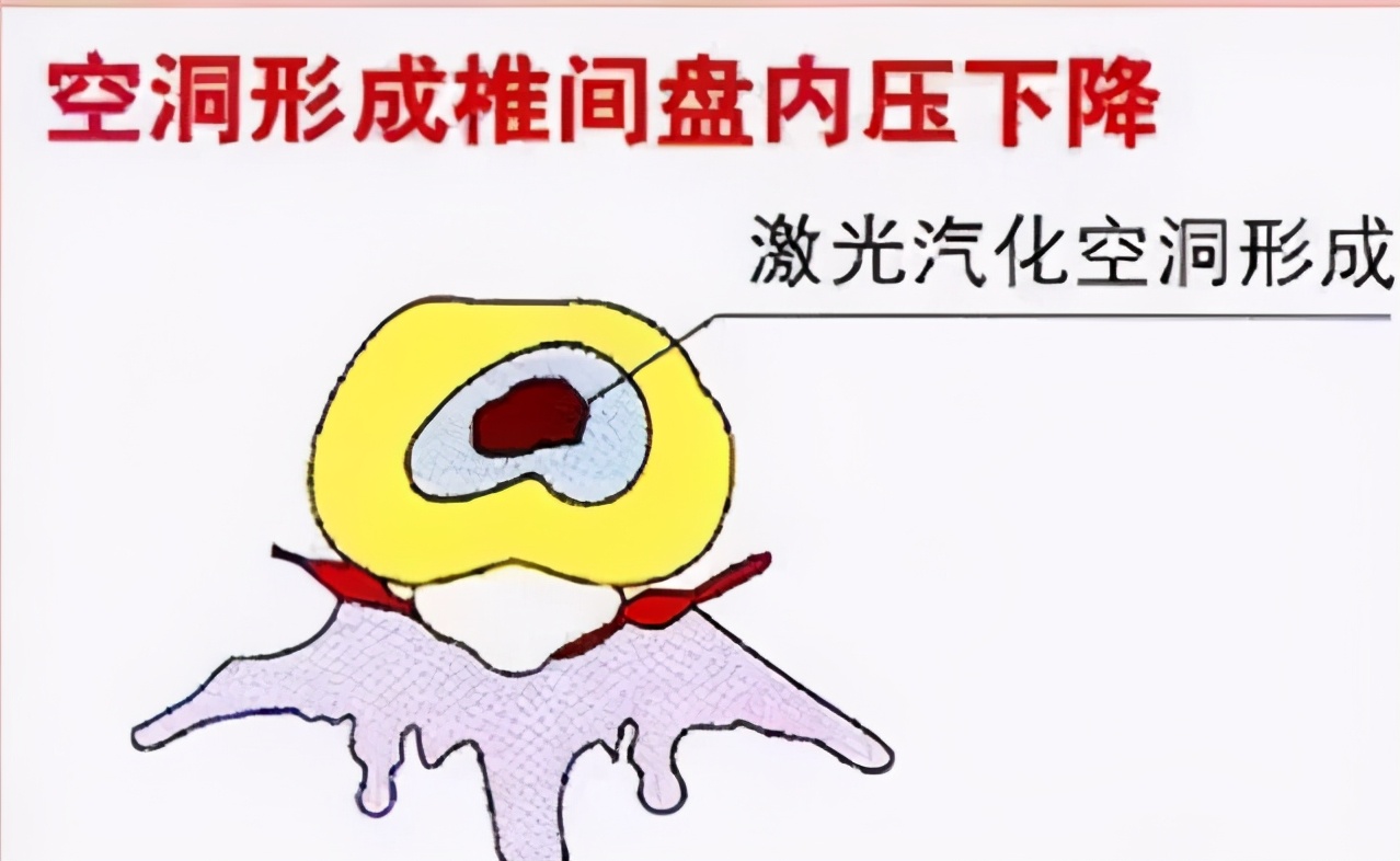 疼痛科需要有什么仪器,疼痛科必须具备的设备