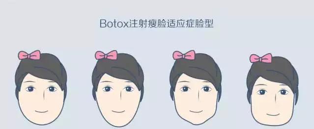 打完瘦脸针后会彻底反弹回去吗,瘦脸针打完会反弹得比以前大吗