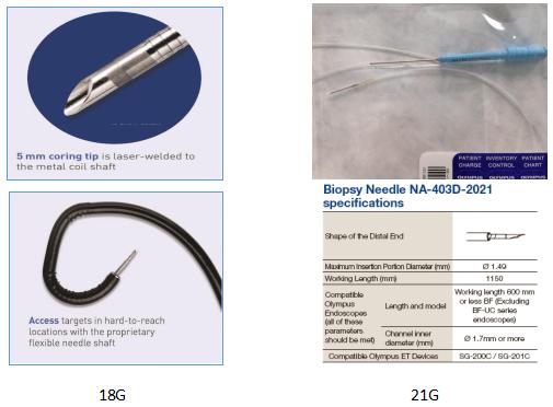 小细胞肺癌的气管镜介入治疗,导航支气管镜在肺癌诊断中的应用