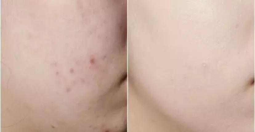 日本这个赛过美白针的王牌内服，让贵妇POLA、SK-II靠边站！