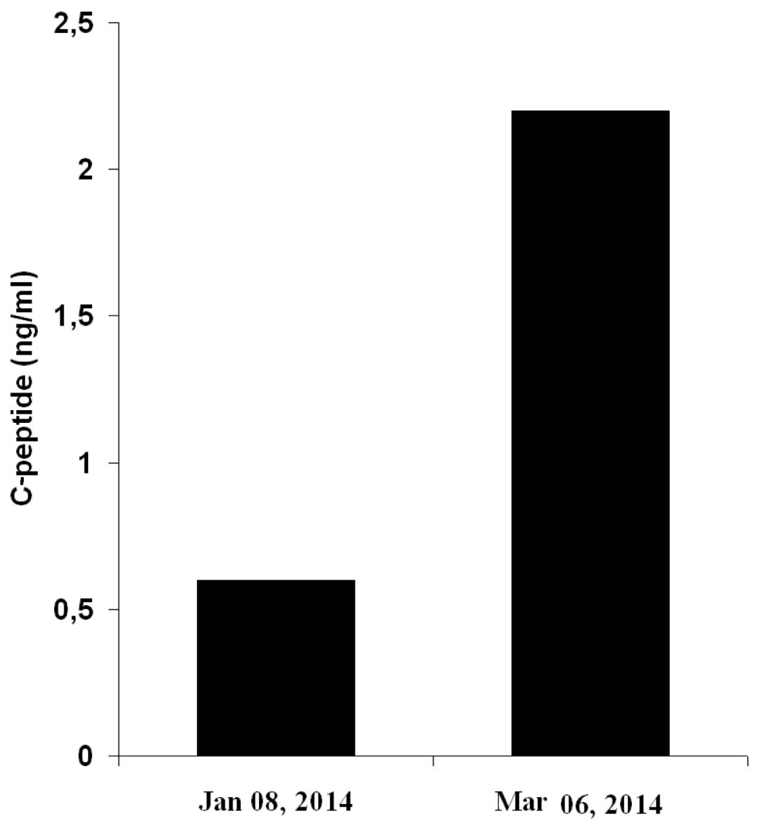 国外1型糖尿病竟奇迹的康复了,年轻人得一型糖尿病有可能痊愈吗