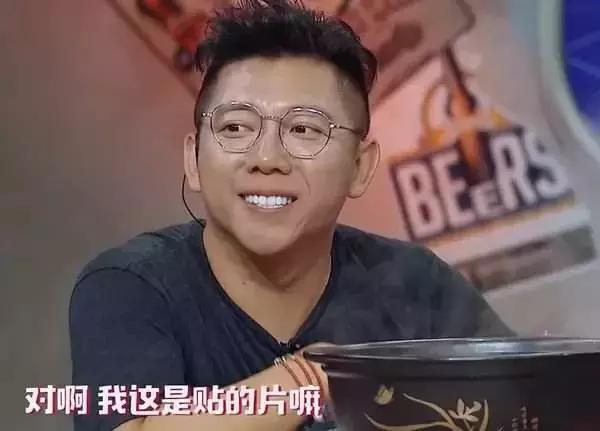 为了变美去整容,整牙堪比整容聊聊我的亲身经历