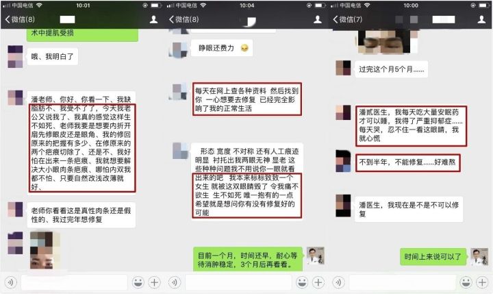 双眼皮整形的真实经历,为什么做双眼皮医生术前不沟通