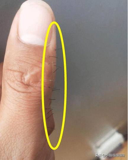 “为啥我大拇指侧面老长毛？”哈哈哈好家伙，你这还自带牙刷功能