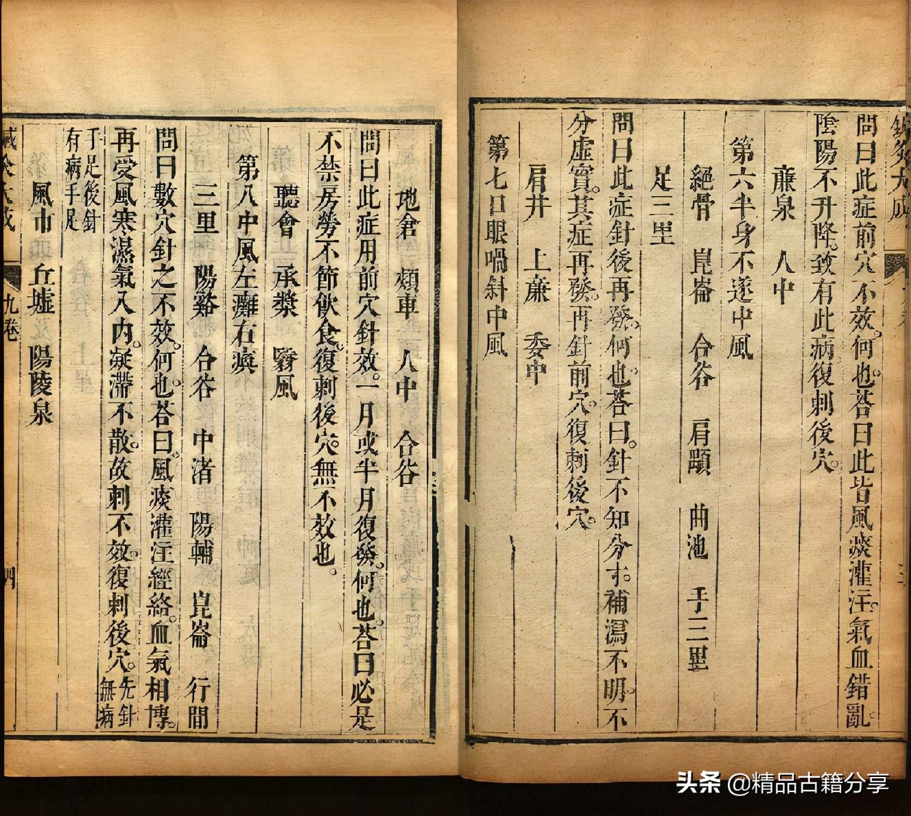 针灸书排行榜前十名,针灸全书阅读