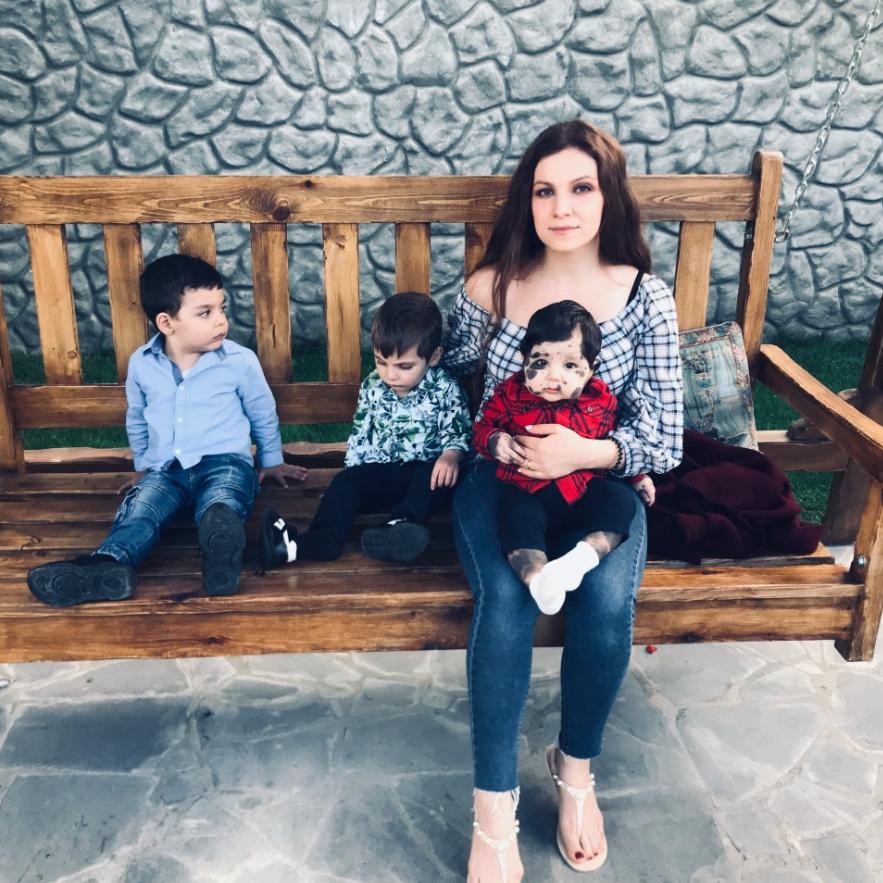 亚美尼亚男童全身布满黑色胎记，医生劝放弃，父母：他是上帝的礼物