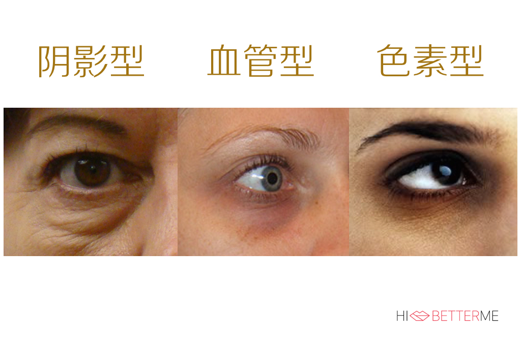 对付黑眼圈最好用的眼霜,真正对黑眼圈有用的眼霜