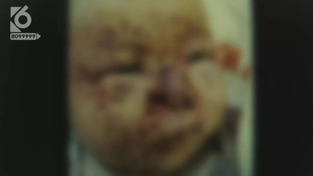 痛心百日女婴惨遭一窝老鼠啃食,三个月大的女婴被老鼠啃后续