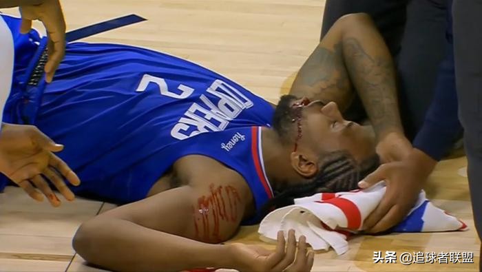 小卡伤了,小卡伦纳德受伤被误伤