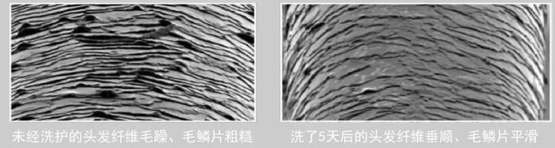 头发毛躁并且脱发推荐洗发水,用什么洗发水改善头皮脱发