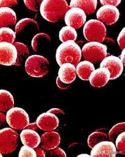 真菌与细菌细胞病毒区别,细菌病毒真菌微生物哪个厉害