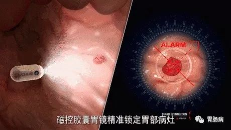 现在做胃镜还很痛苦吗,做胃镜医生说没事但还是疼