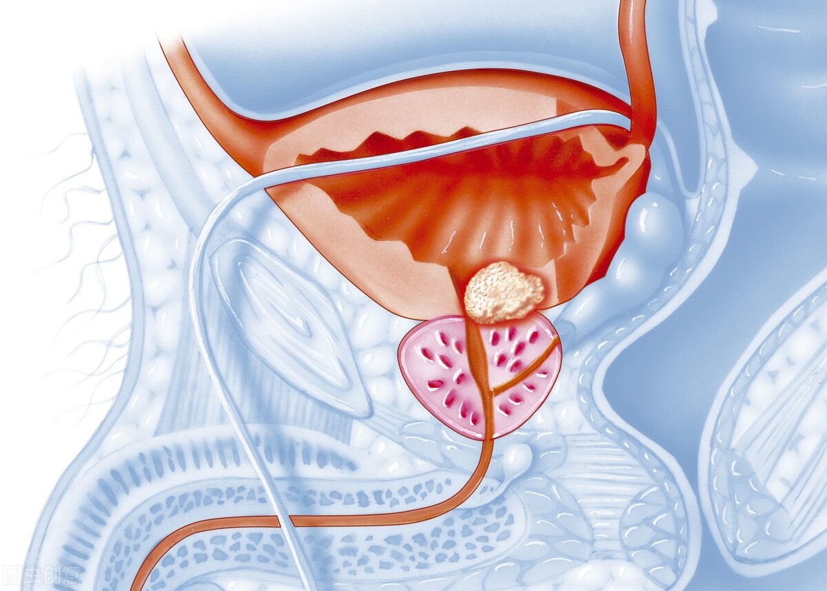 6个小妙招远离前列腺疾病,男性必知前列腺的求救信号