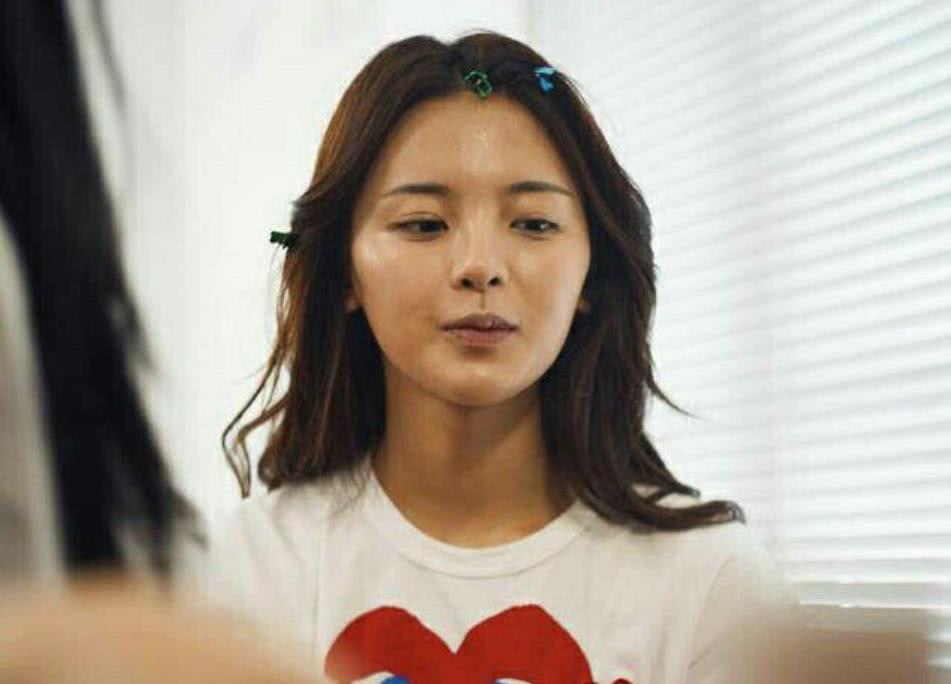 娲昏鍖栫榾鐨勪腑鎴愯嵂鍙互娣″寲鏂戠偣,娲昏鍖栫榾鍏婚鑽湁鍝簺