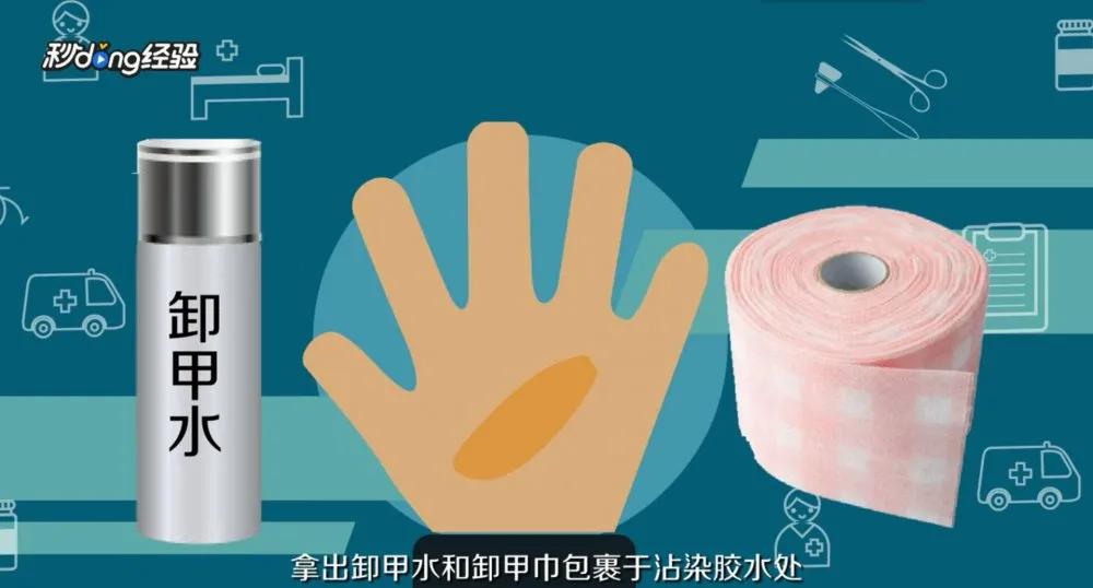 手被502胶水粘住了很长时候怎么办,手指被502胶水粘住分不开了怎么办