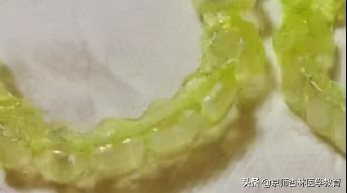 戴过的隐形牙套怎么收纳,隐形牙套随身携带清理