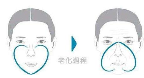 法令纹苹果肌下垂有什么办法改善,如何改善法令纹和苹果肌下垂
