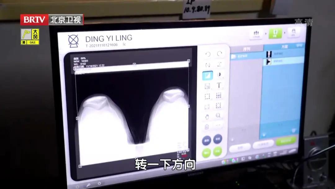 跑步怎么样才能避免膝关节磨损,2个小动作帮助延长膝盖寿命