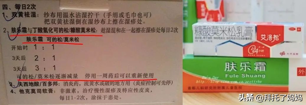 网红用的湿疹膏,湿疹要不要信迷信