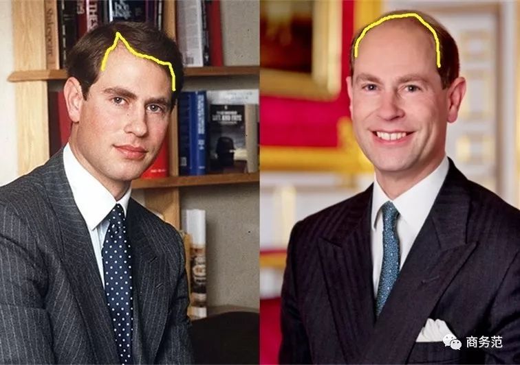 贝克汉姆脱发最新消息,大卫贝克汉姆脱发