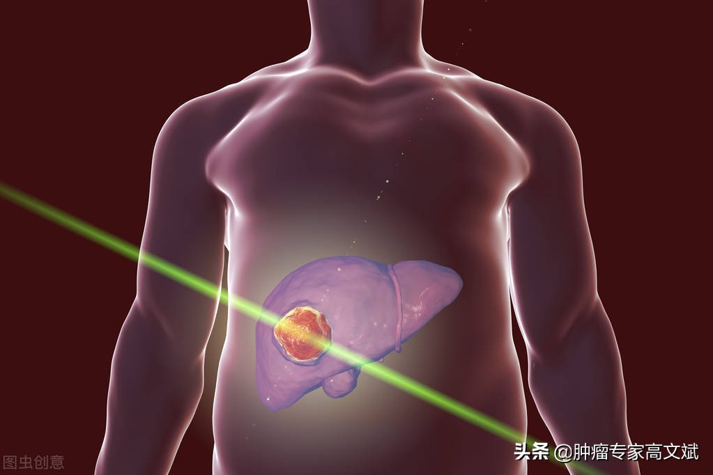胰腺癌手术复发转移看什么,胰头癌手术后复发转移的症状