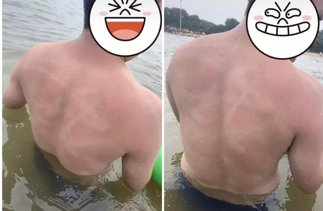 甜馨怎么这么白了,甜馨为啥那么黑