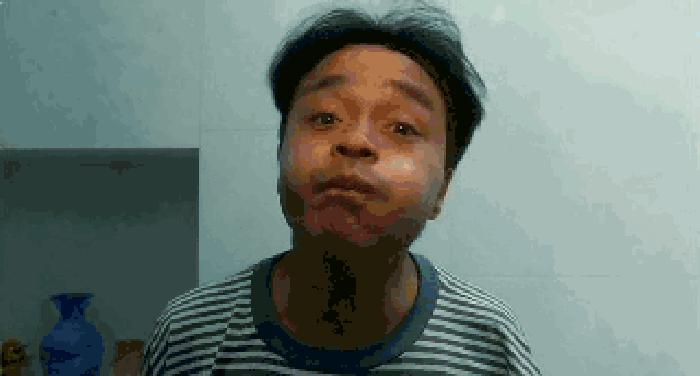 人类做过最勇猛的事，就是在口腔溃疡上撒盐